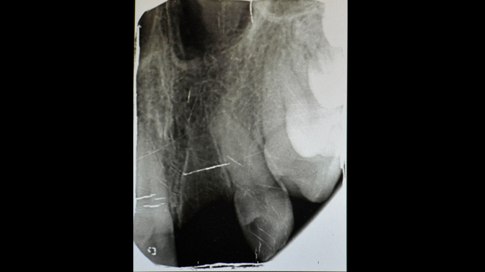 Kaza geçirdi! Asla olmaz diye düşündüğü şey oldu!