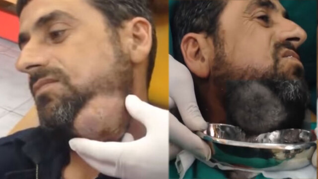 Boynundan çıkanlar görenleri şoke etti!
