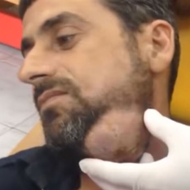 Boynundan çıkanlar görenleri şoke etti!