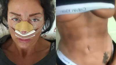 Estetik bağımlısı: En azından tabutumda güzel görüneceğim