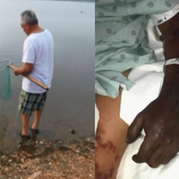 Yengeç avlamaya gitti, hayatı kabusa döndü!