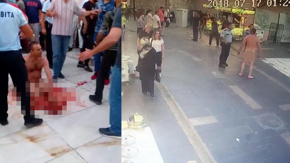Eyüpsultan'da çıplak adam dehşeti