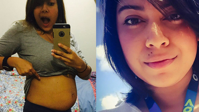 Şiş karın ve bel ağrısıyla hastaneye gitti, şoke oldu!