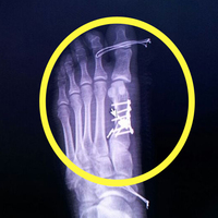 Röntgeni görünce hayatının şokunu yaşadı!