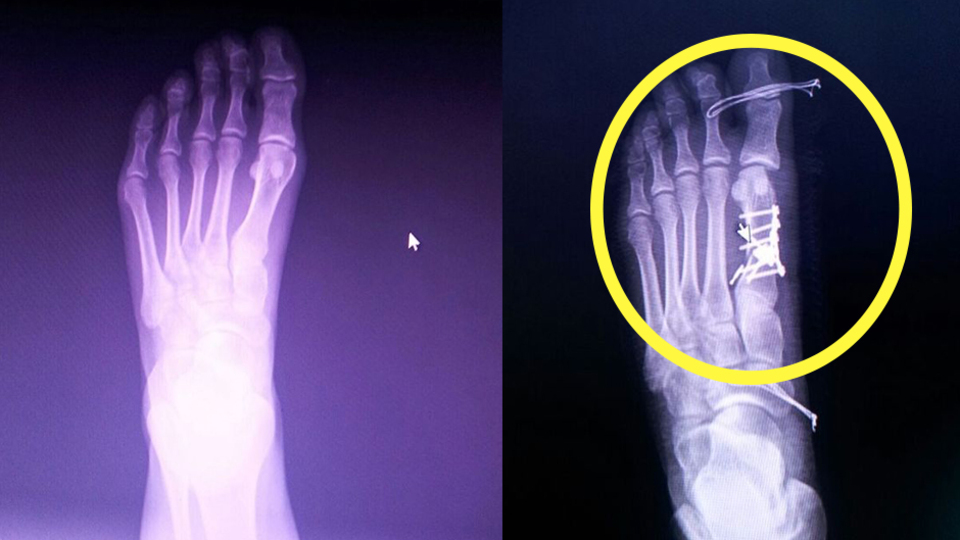 Röntgeni görünce hayatının şokunu yaşadı!