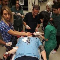 Kafasında kaldırım taşı kırmışlardı! Bakanlık'tan açıklama geldi!