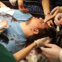 Doktora vahşi saldırı! Başında kaldırım taşı kırdılar!