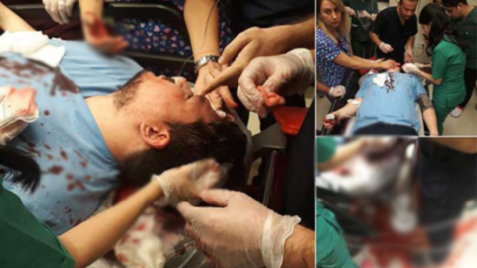 Doktora vahşi saldırı! Başında kaldırım taşı kırdılar!