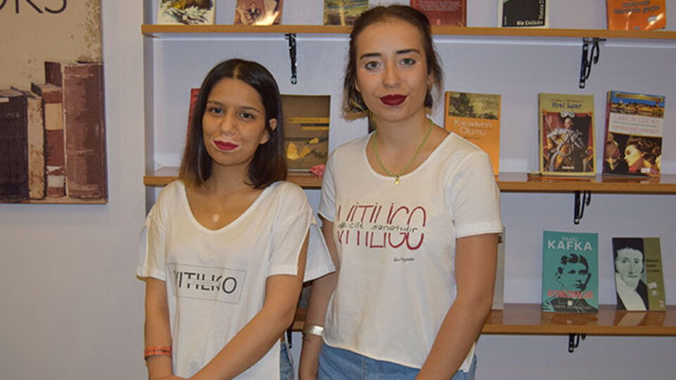 15 yıldır vitiligo hastası kız, bakın vitiligoyu neye benzetti!