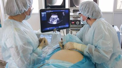 Doğmamış bebeğe beyin ameliyatı