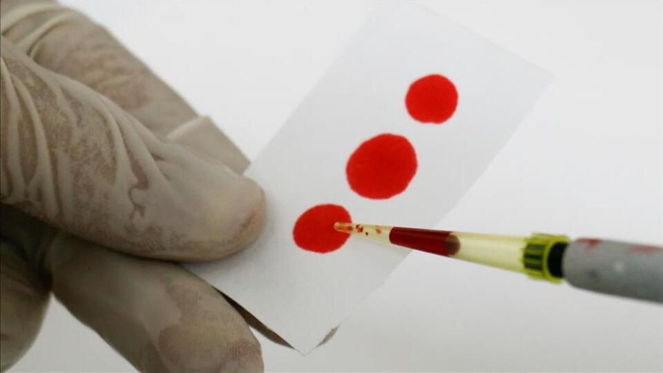 'Kayıp hepatitli kalmasın'