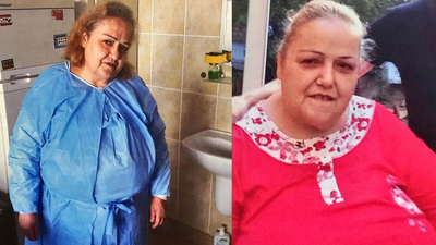 Mide ameliyatı sonu mu oldu?