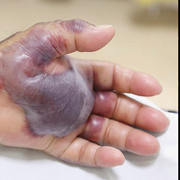 Çiğ yedi, elinden oldu!