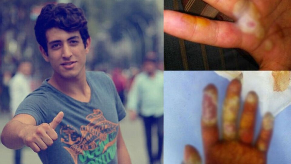 Radyoaktif tespih yüzde 80 engelli bıraktı