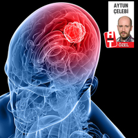 İşte en 'radyasyonlu' telefonlar! İlk 3'e dikkat!