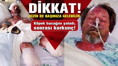 Dikkat! Sizin de başınıza gelebilir! Köpek bacağını yaladı, sonrası korkunç