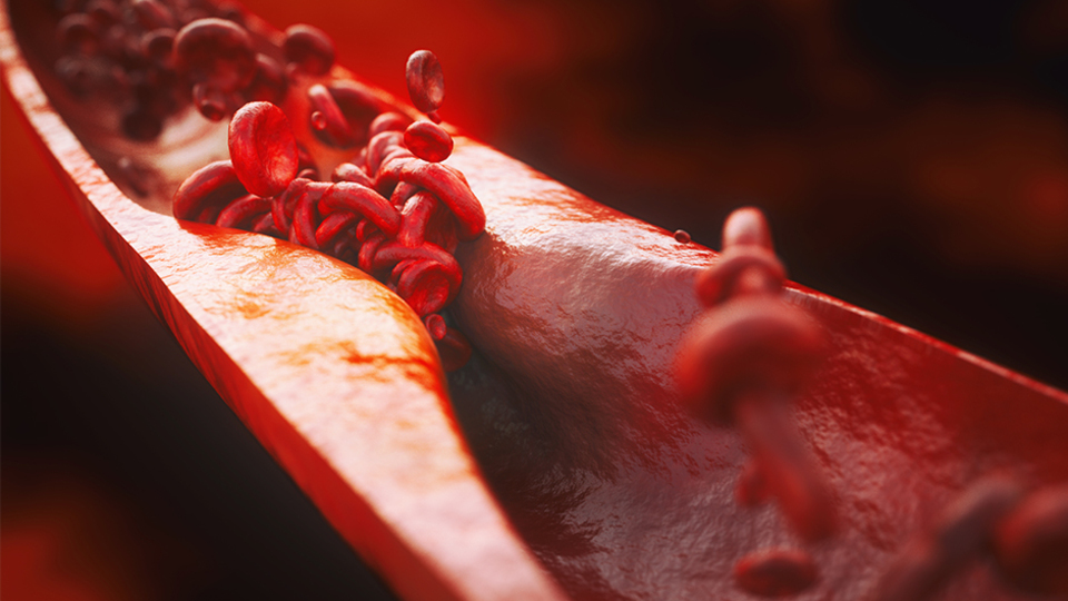 Türk bilim insanları, kolesterolü düşürmek için bir ilke imza attı!