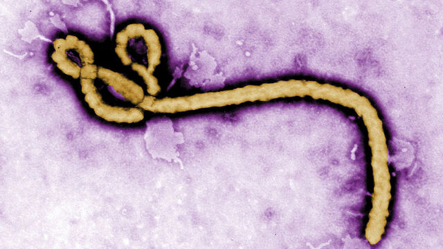 Yeni bir tür Ebola virüsüne rastlandı