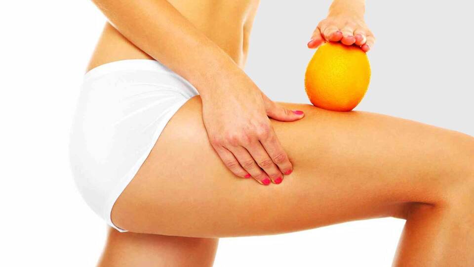 İşte selülite yol açan en önemli neden!