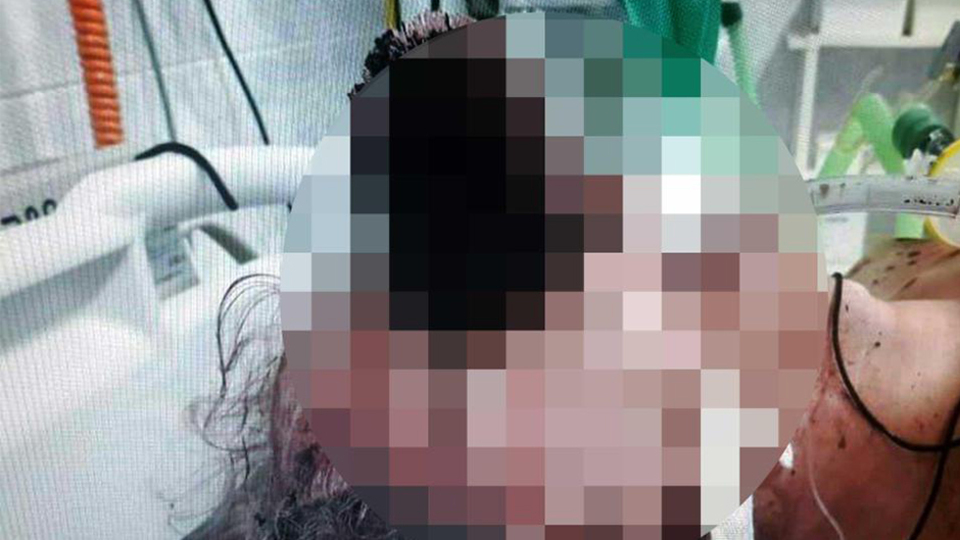 Şoke eden ölüm! Tuvalet fırçası gözüne saplanınca...