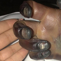 Yengeç avlamaya gitti, hayatının şokunu yaşadı!