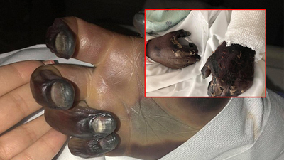 Yengeç avlamaya gitti, hayatının şokunu yaşadı!