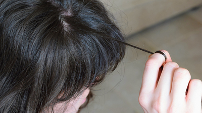 Saç, sakal, kaş koparıyorsanız bu haber size!