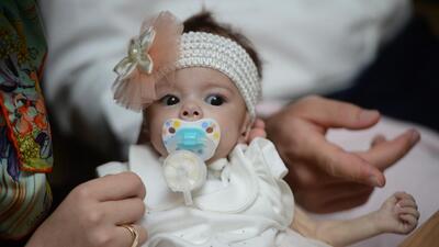 Türkiye'de en düşük ağırlıklı karaciğer naklini gerçekleştirdiler