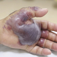 Onun hayatı herkesinkinden daha zor! İşte son hali...