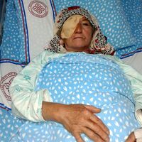 Katarakt ameliyatı sonrası enfeksiyon iddiası!