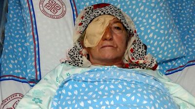 Katarakt ameliyatı sonrası enfeksiyon iddiası!