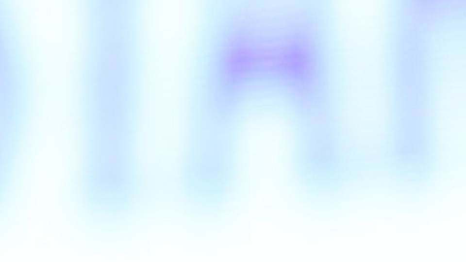 TEB Genel Müdürü'nden kur açıklaması