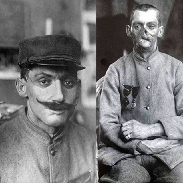 Savaşta yaralanan askerlerin hayatını bu maskeler kurtardı!