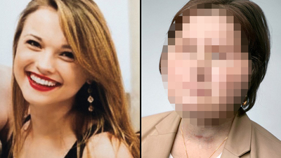 Yüzü paramparçaydı! İşte müthiş değişimi...