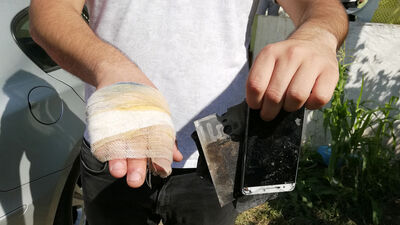 Patlayan cep telefonu yaraladı