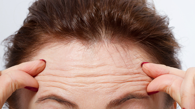 Alındaki kırışıklığın nedeni yaşlılık değilmiş!