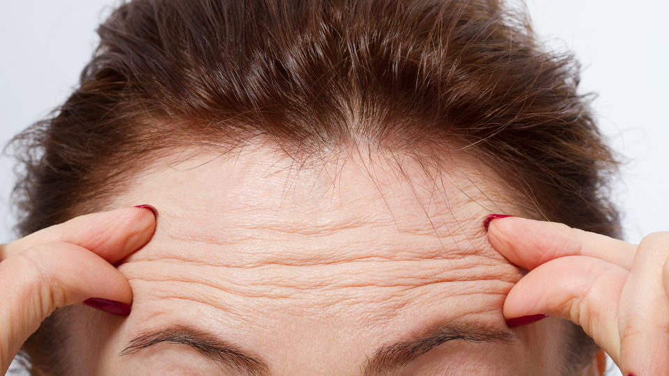 Alındaki kırışıklığın nedeni yaşlılık değilmiş!