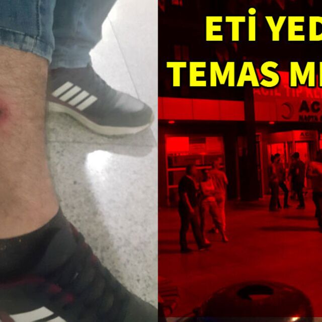 Şarbona nasıl yakalandığını anlattı!
