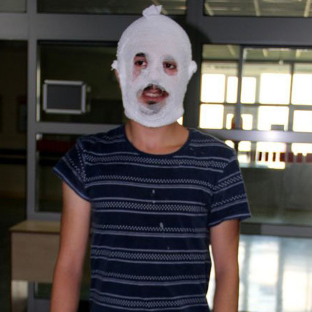 Yüzüne krem sürdü, bu hale geldi!