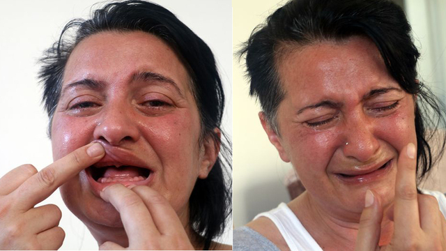 32 dişi çekildi, ötanazi istedi! Şimdi ise...