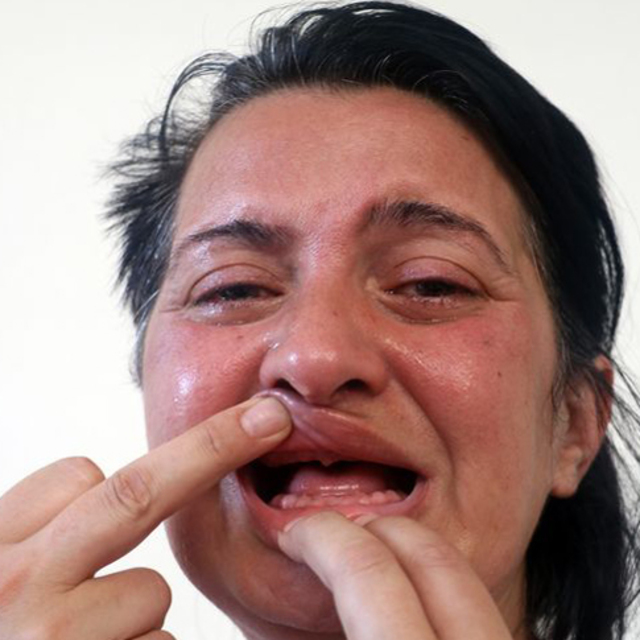 32 dişi çekildi, ötanazi istedi! Şimdi ise...