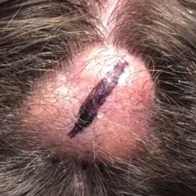 20 yıl bu şekilde yaşadı! Kafasından çıkanlar şoke etti