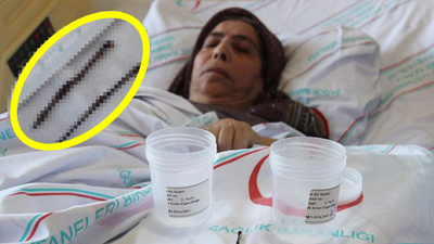 Vücudundan çıkanlar doktorları bile şoke etti!