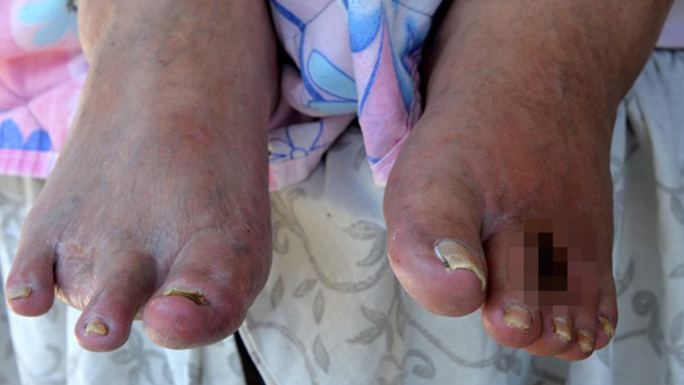 Acıdan başını duvarlara vuruyor! Parmaklarının kesilmesini istedi!