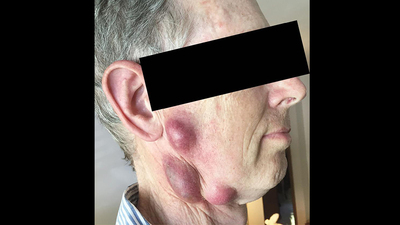 O bakteri önce kedisini öldürdü, sonra da...