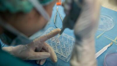 O hastalıkların yıllık maliyeti 70 milyar lira!