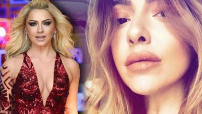 Dudaklarına ne oldu Hadise?