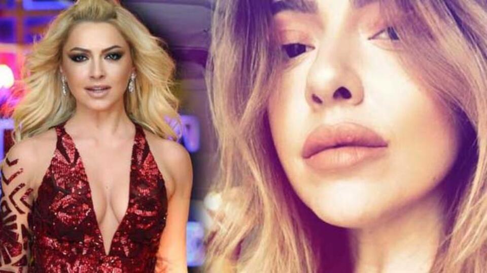 Dudaklarına ne oldu Hadise?