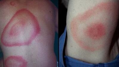 AIDS'ten bile daha tehlikeli! İşte çağın salgını...