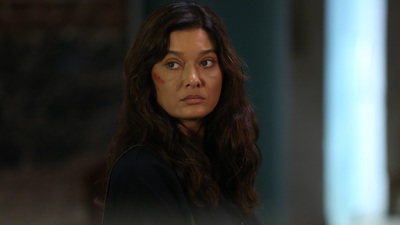 "Siz benim canımı yakmadınız, söküp aldınız!"